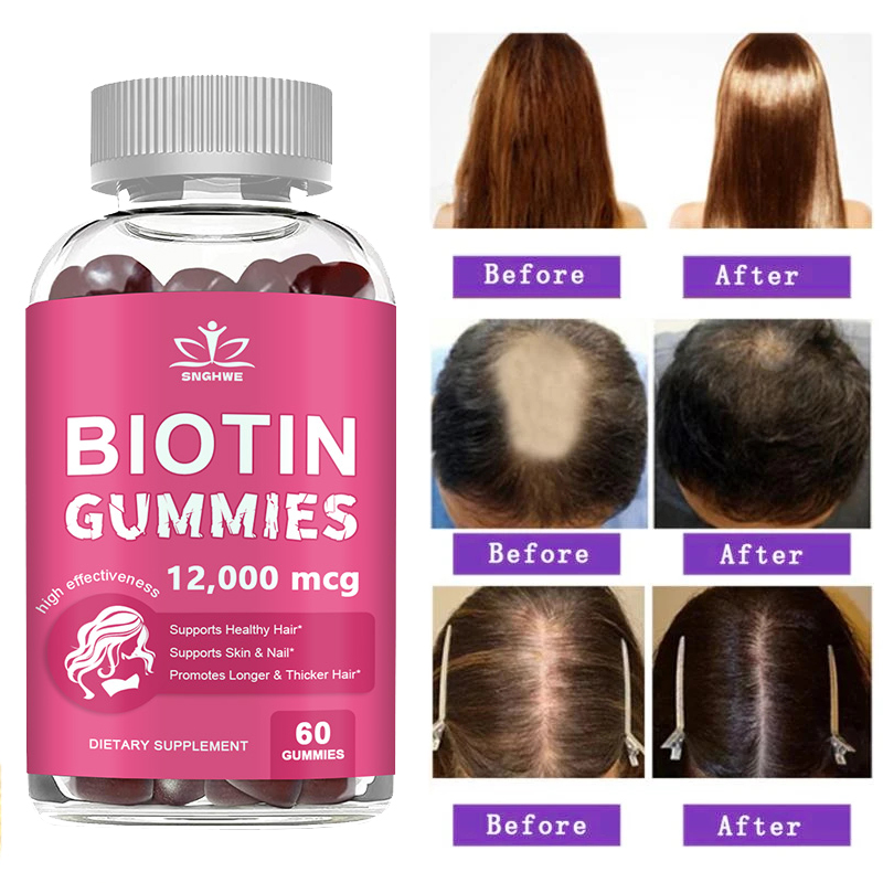 Kollagen-Gummis, Biotin-Gummis – Hair Care Gummies Bewertung und Preis